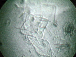 �a�c�e�ቷ�΍�܂̌��ʊm�F�摜�ł��B�Q