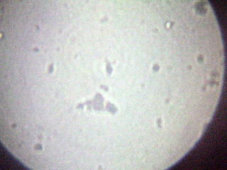 �o�C�I�f�B�[�[���ɐ����������s��摜