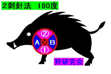 電殺　２刺針法　刺す場所が２ヶ所